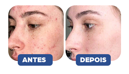 Antes e Depois 2