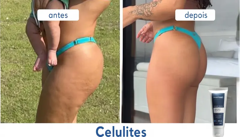 Antes e Depois 4