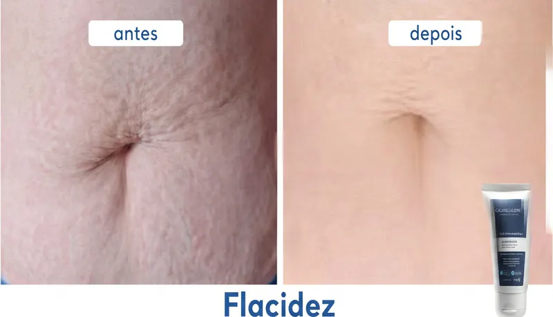 Antes e Depois 5