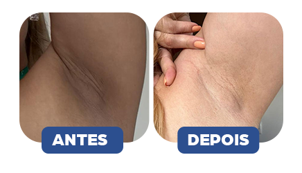 Antes e Depois 1
