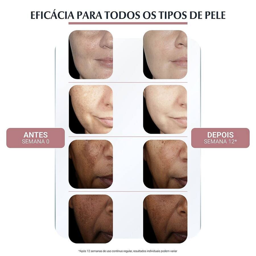 Antes Semana 0 e Depois Semana 12: eficácia para todos os tipos e tons de pele