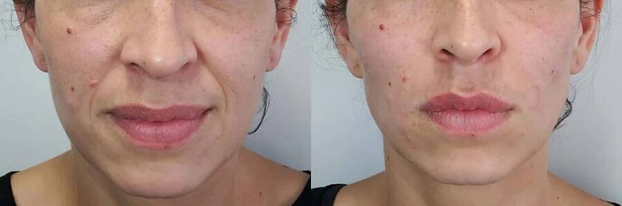 Luciana M. — antes e depois
