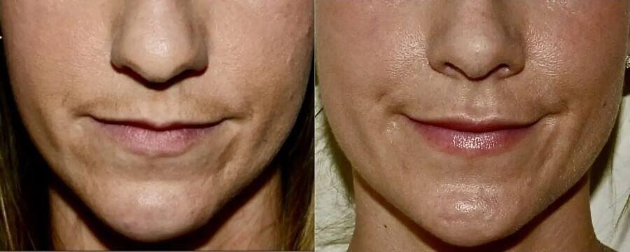 Cristiane B. — antes e depois