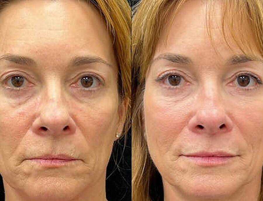 Patrícia R. — antes e depois