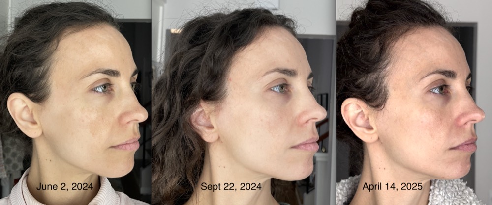 Resultado Márcia S.