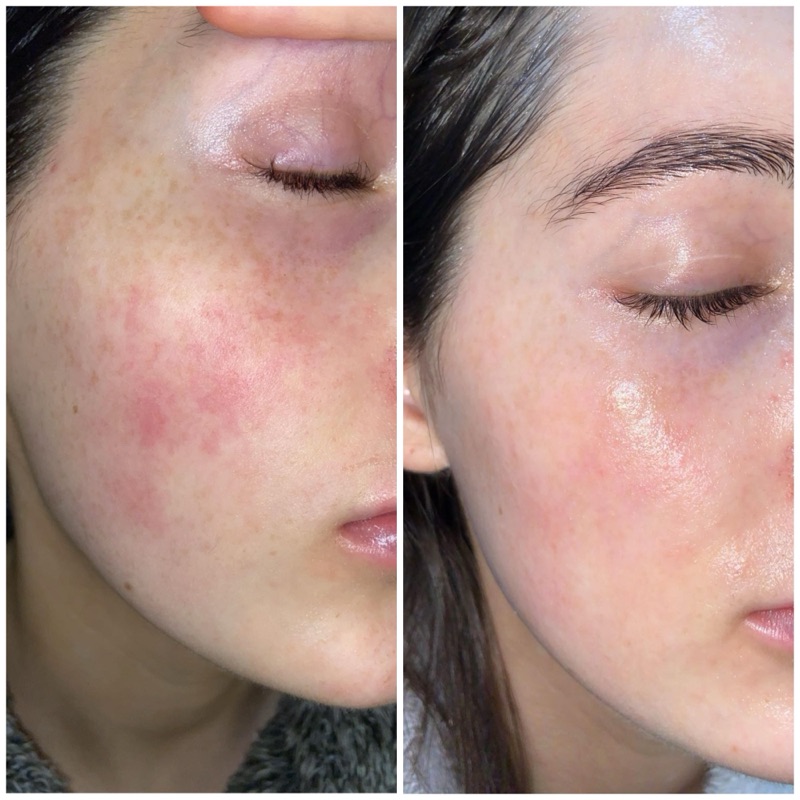 Resultado Luciana P.